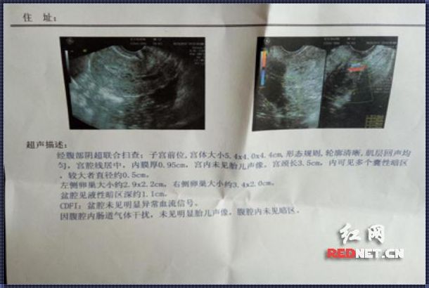 怀孕做b超检查需要多少钱: 检查怀孕b超多少钱?