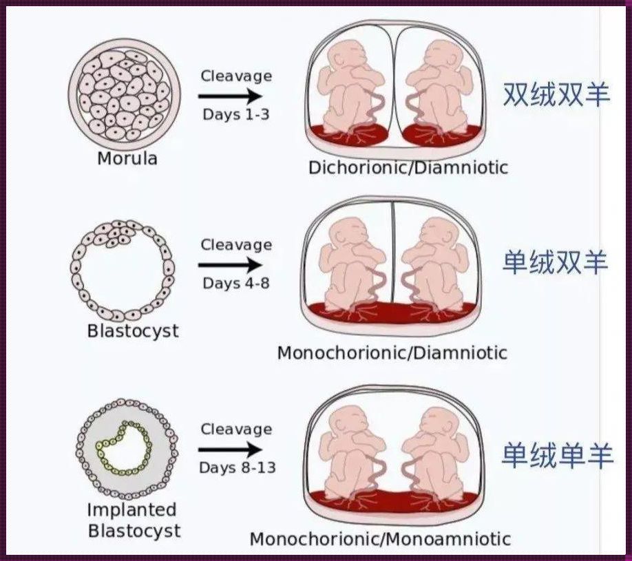 单卵为什么会裂变成双胎(一卵双胎是怎么形成的)