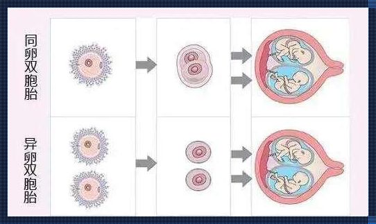 单卵为什么会裂变成双胎(一卵双胎是怎么形成的)