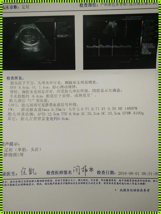 怀孕39周（孕39周还不生的原因）