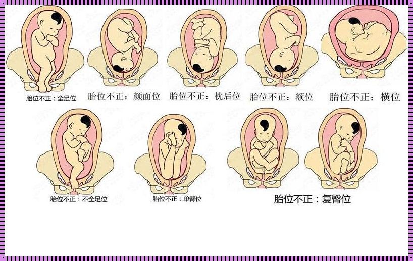 多少周胎位固定不会变动了（胎儿在几周固定胎位）