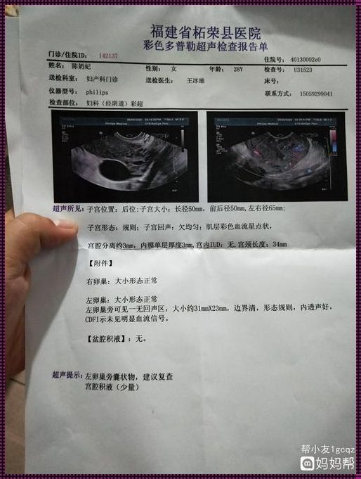 引产后42天复查都检查什么（引产后42天复查什么科,引产后多久复查什么）