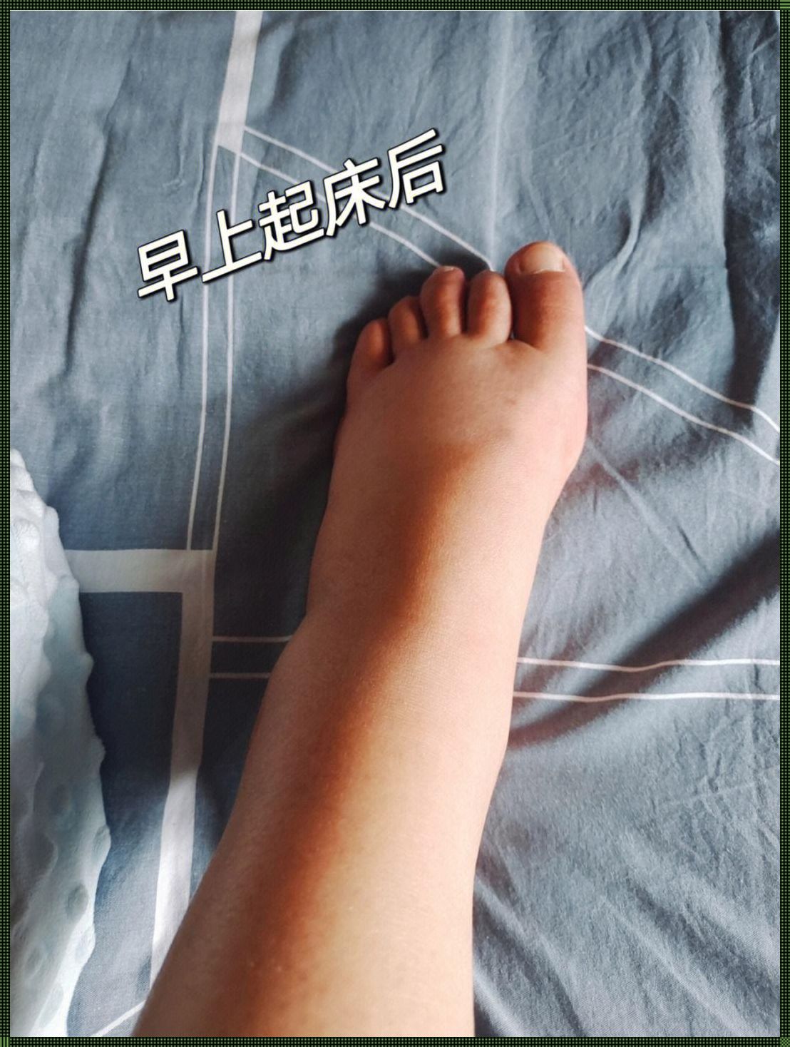 怀孕脚肿就是女孩吗（什么办法防止事后怀孕）