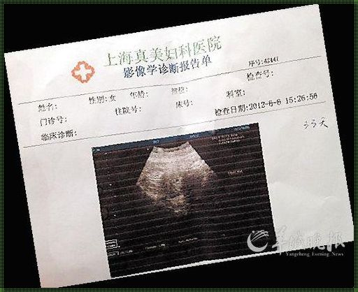 怀孕一个月怎么打掉最安全: 怀孕一个月了 要用什么方法打掉才好啊