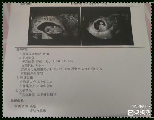 九周暗示男女[b超单怎么分辨男女?b超单子上有男女暗示吗?]