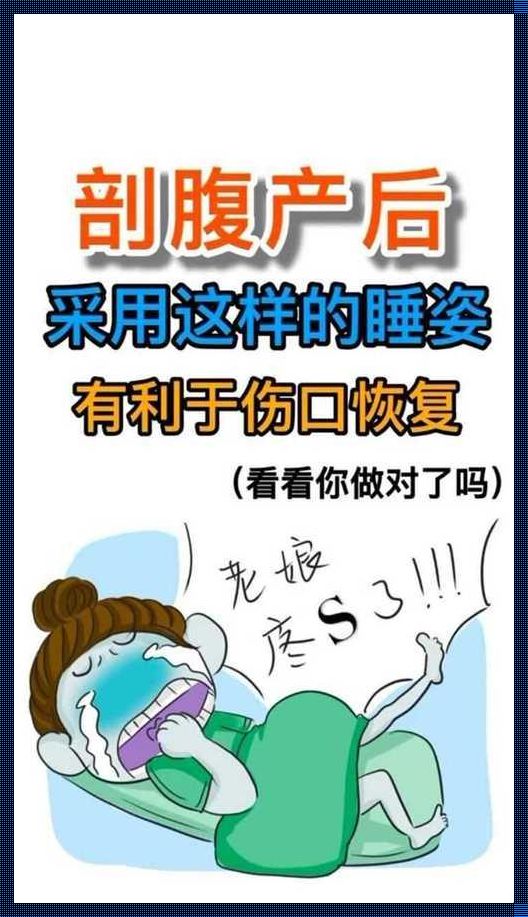 剖腹产后正确睡姿图：保护母婴健康的重要指南