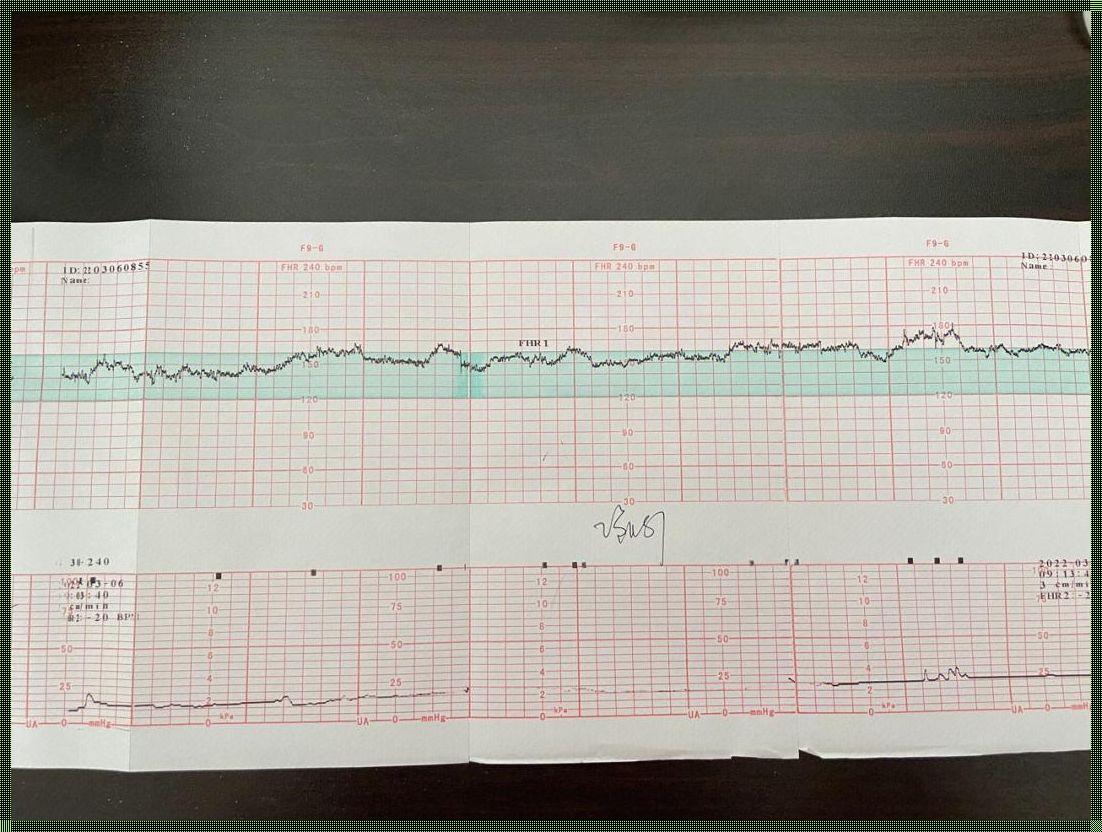 孕晚期胎心监护多久做一次：关爱母婴健康，专业解答