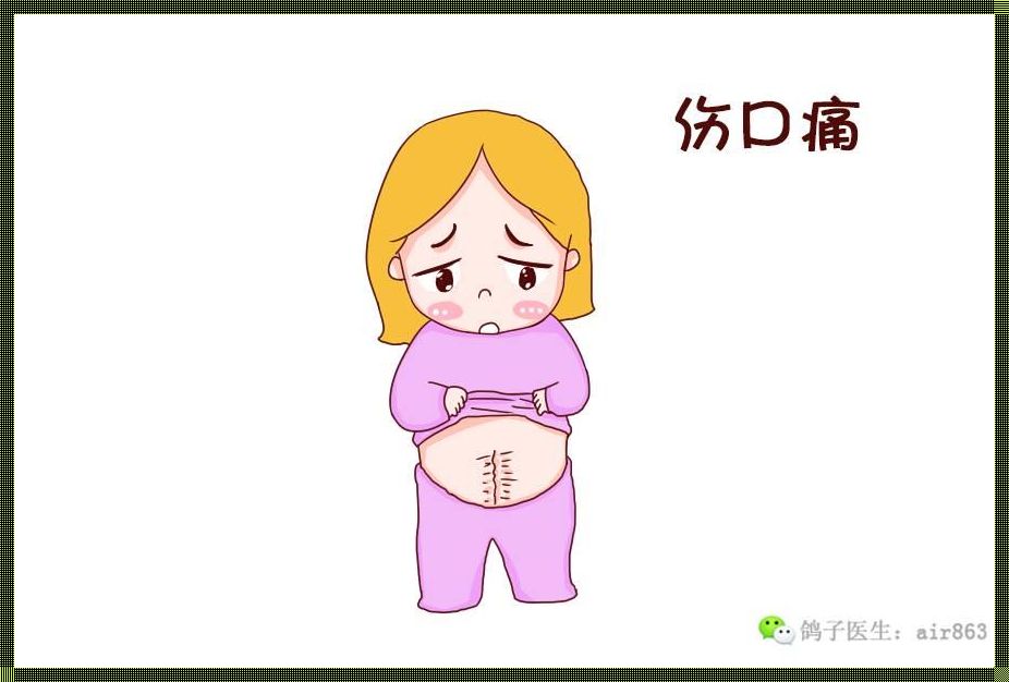 剖腹产后最疼是哪一天：新妈妈们的真实感受