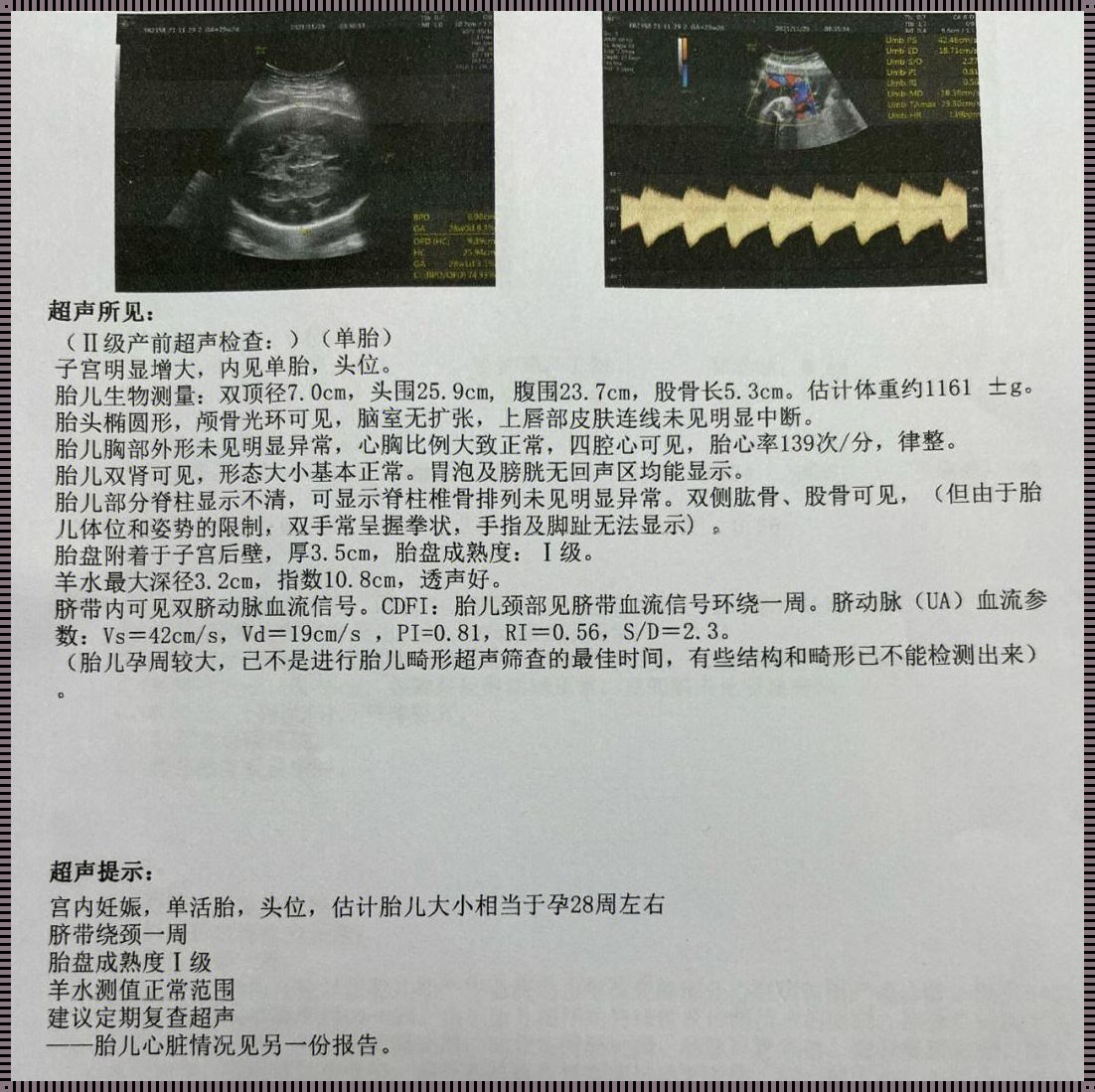 孕期胆囊偏小，悉心照料守护母婴平安