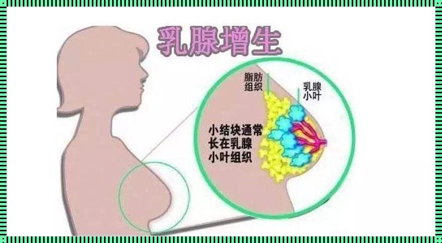 乳腺增生的自我管理指南