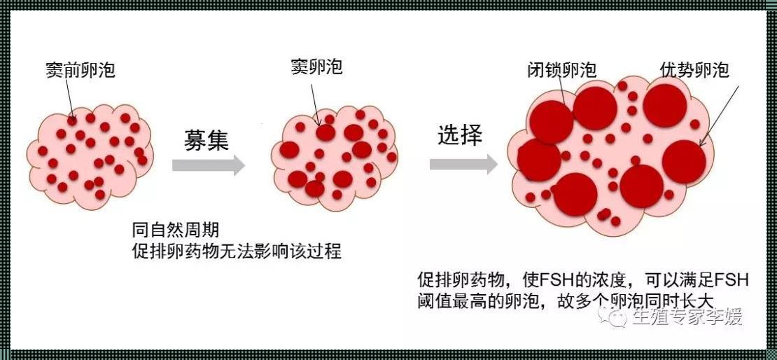 试管促排“惊现”30 枚卵泡，备孕路上的“里程碑”