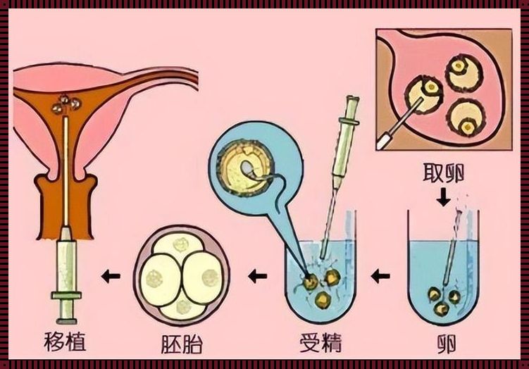 供卵试管婴儿：我的备孕惊现之旅