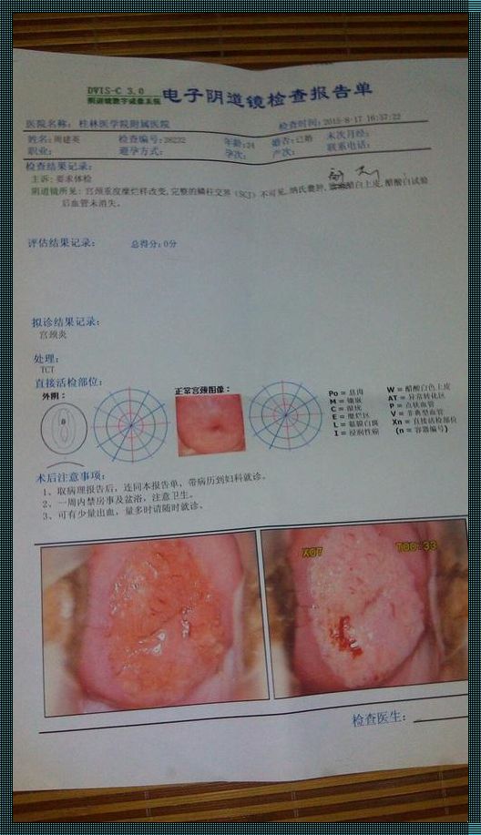 中度宫颈糜烂：探秘、对待与分享