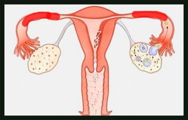 排卵期肚子疼，输卵管堵塞的疑虑与解析