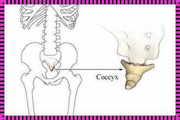 剖腹产后尾椎骨疼，产后惊现之谜