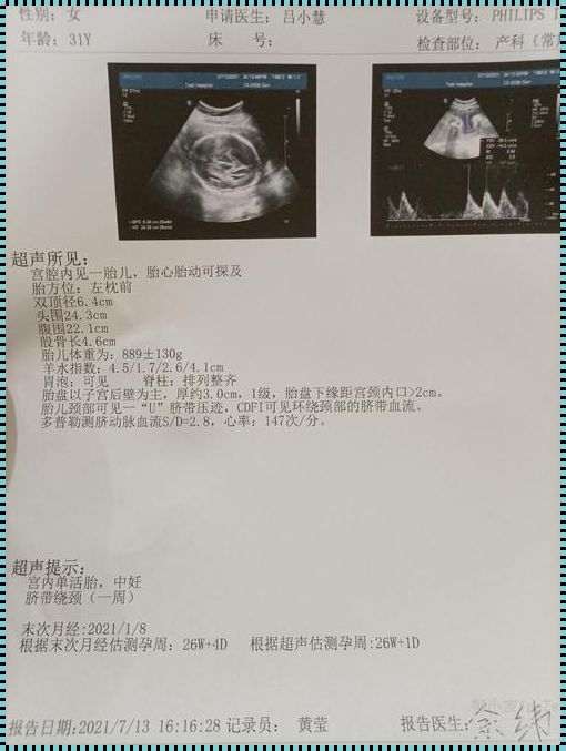 26 周宝宝体重揭秘：育儿规划新篇章