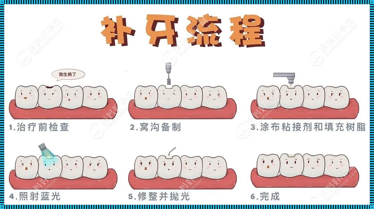 儿童补牙过程图解：育儿路上的惊现之旅