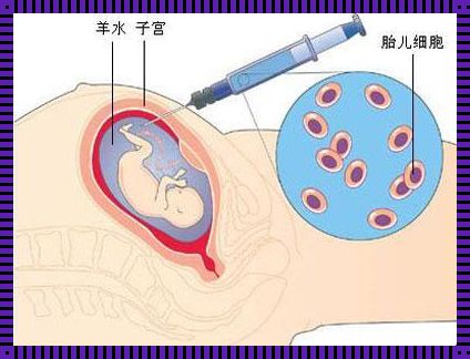 羊水穿刺检查：利大于弊的胎儿体检之道