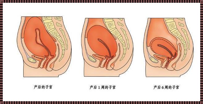 产后子宫体的变化：你知道多少正确的事项？
