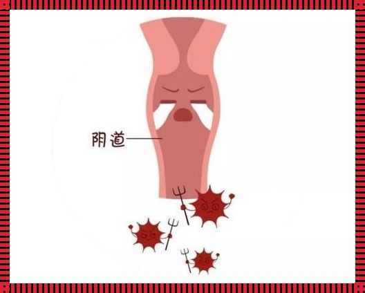 产后细菌性阴道炎：自愈可能与对策