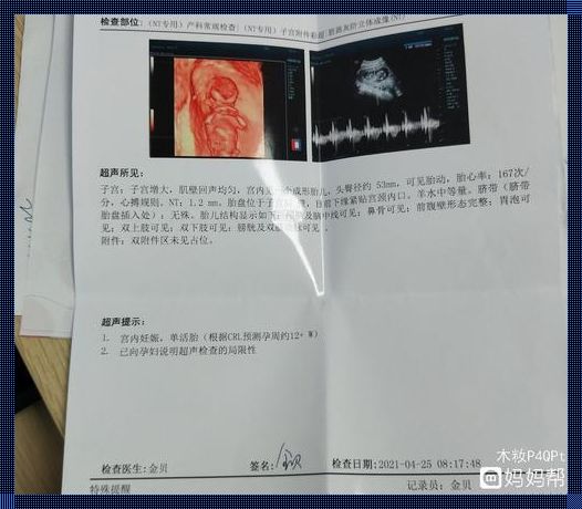 怀孕12周：母婴健康的护航之旅