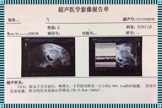 怀孕怎么才能知道男女？揭秘其中的科学与实践