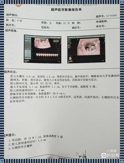 十二周胎心170：孕育新生命的惊喜与挑战