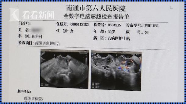 揭秘怀孕报告单：如何识别怀孕迹象？