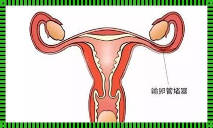 月经量少与输卵管堵塞的微妙联系——备孕路上的我们该如何应对？