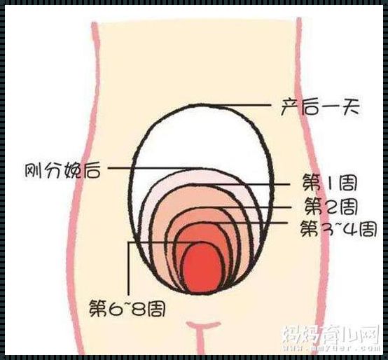 引产后子宫收缩：一个令人振奋的发现