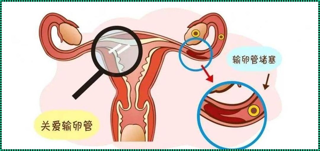 探索小手指自测输卵管通畅的可能性——备孕路上的幸福指南