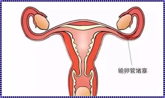 《输卵管是否堵塞自测——备孕路上的关键一步》