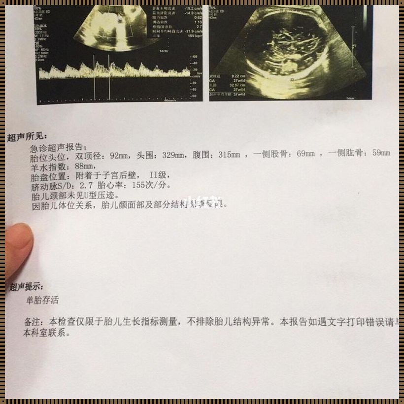 36周孕期的抉择：保胎还是迎接新生命？