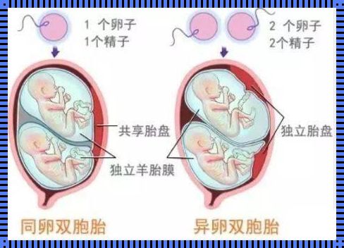 异卵双胞胎智力较低：备孕与问鼎