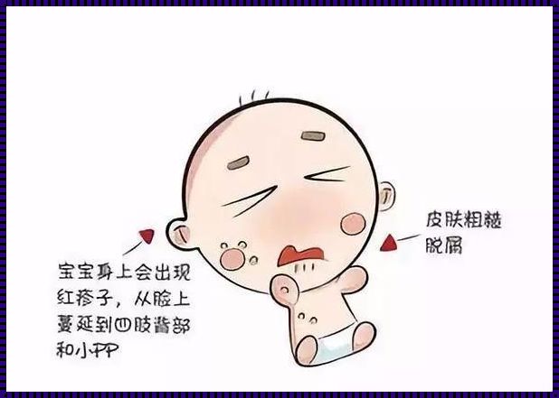 婴幼儿湿疹：一场温柔的抗争