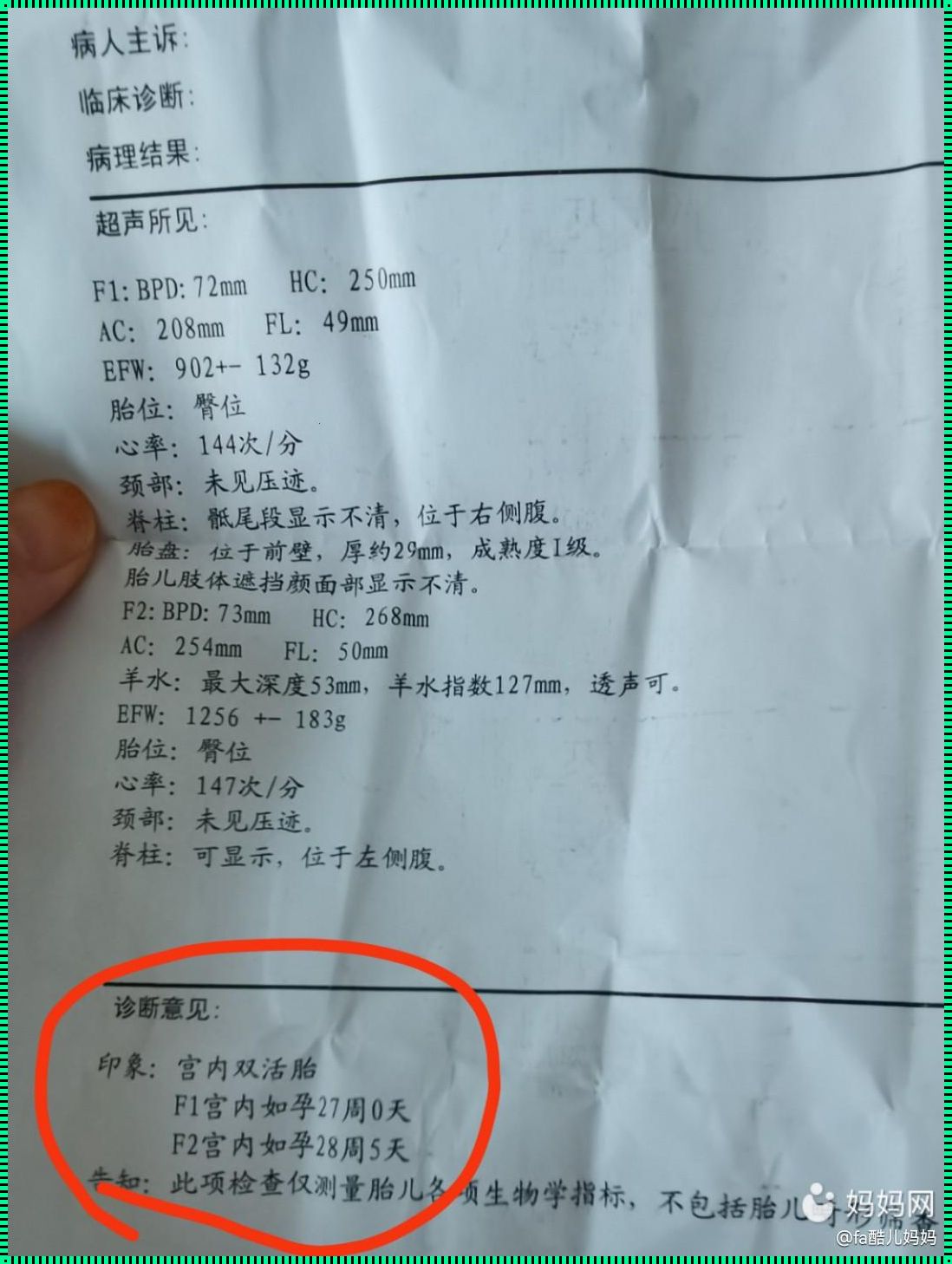 单绒双羊双胞胎：温馨剖腹产的奇迹