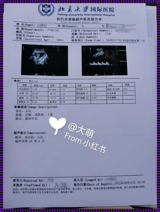 28周小排畸，孕期中的一场惊喜之旅