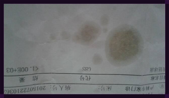 怀孕37周检查B族链球菌阳性：我的激动与中肯