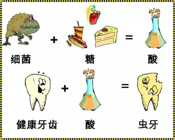 《儿童蛀牙的原因：仁心父母的育儿之路》