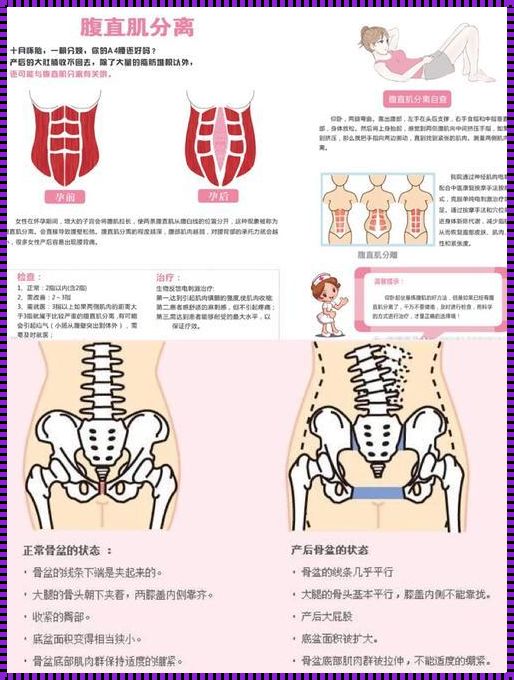 重塑自我：产后盆底肌修复的新篇章