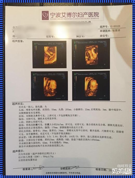 四维检查23周还是24周，哪个时间点更适合您？