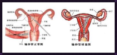 调好气血，输卵管就通了：让准妈妈们远离输卵管不通烦恼