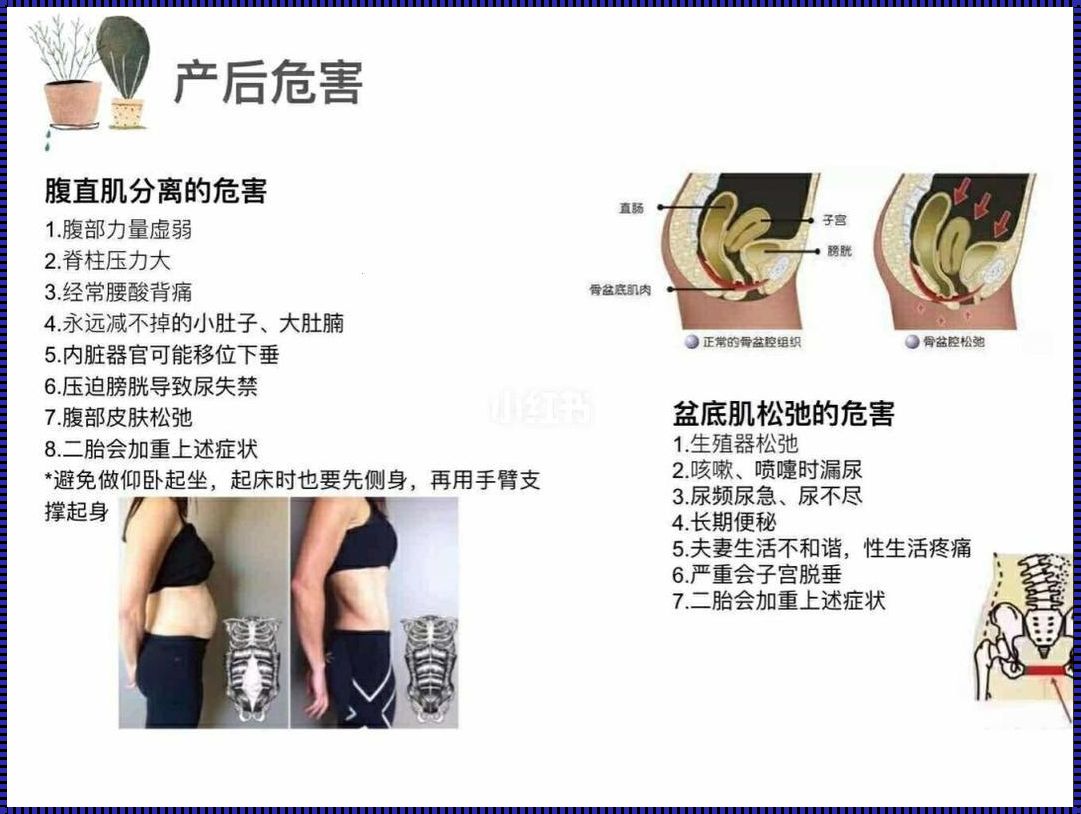 为什么产后一年不建议做卷腹