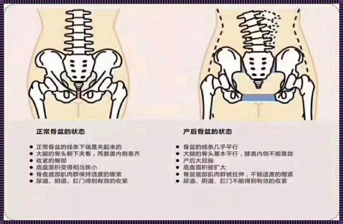 《产后下面松弛，如何重拾紧致与自信》