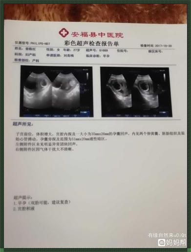 孕囊旁积液是怎么回事——解密孕期里的“液体”秘密