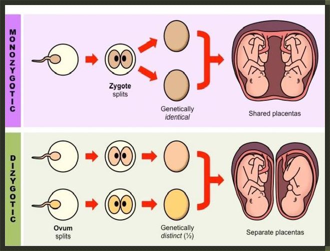 同卵双胞胎和异卵双胞胎的区别：探寻生命奥秘的两种奇观