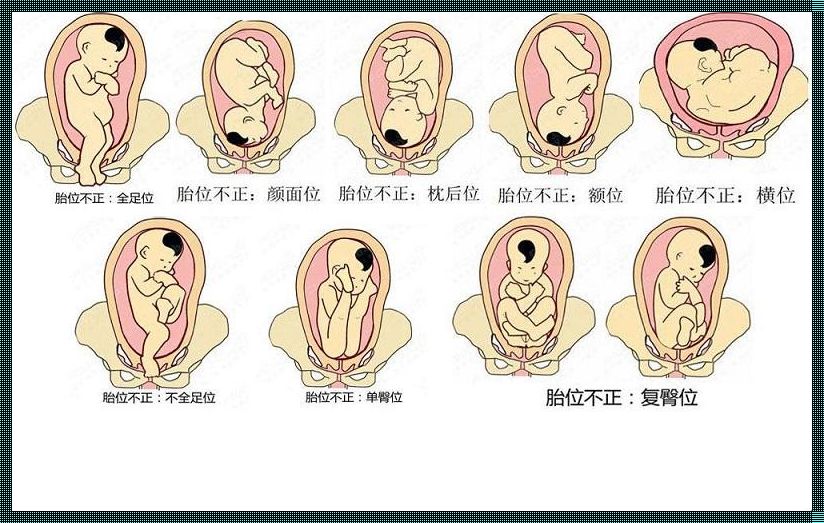 胎位左枕前是入盆了吗——穿越时空的孕育之旅