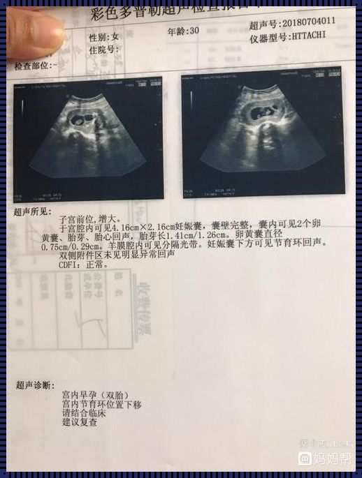 一个卵黄囊会变成两个吗？——备孕路上的探索与发现