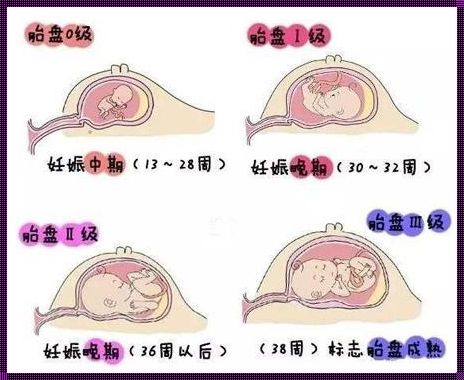 37周胎盘成熟度1级正常吗：惊现怀孕中的知识盲点