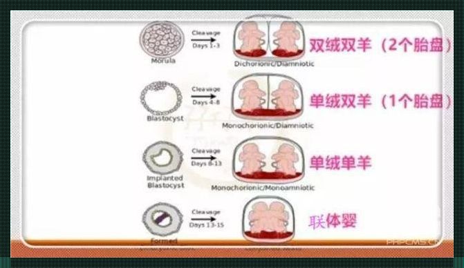 异卵双胞胎是怎么怀上的：揭秘备孕技术背后的奥秘